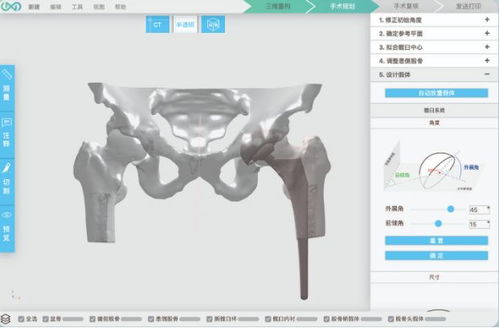 3d打印人體骨骼 這家哈佛大學(xué)孵化的公司要為中國醫(yī)生開發(fā)自己的軟件平臺...